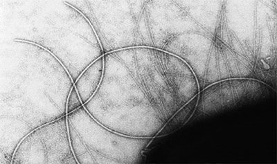 Transmission electron micrograph of an Aeronmonas bacterial cell showing pili (thin fibers) and flagella (thick fibers).