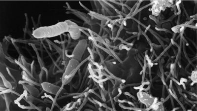Scanning electron micrograph of Aeromonas sp. bacteria adhering to human epithelial cells.
